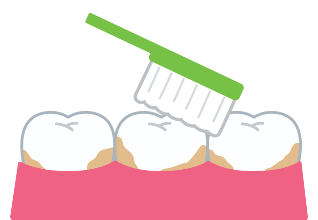 ブラッシング方法