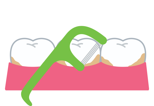 デンタルフロス