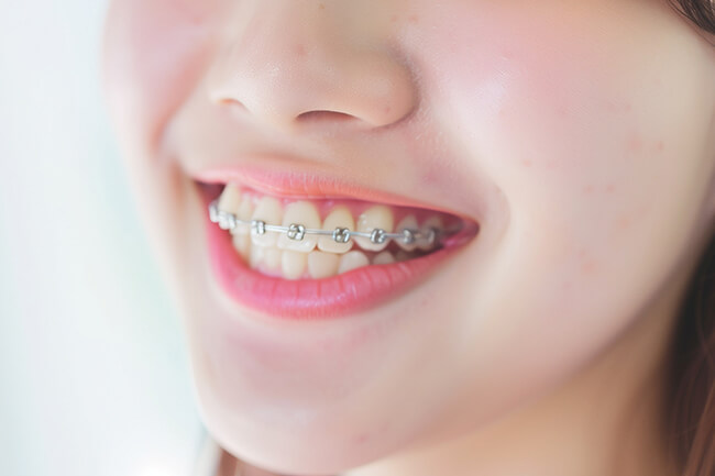 矯正歯科について