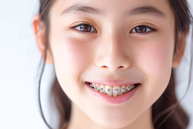 小児矯正について