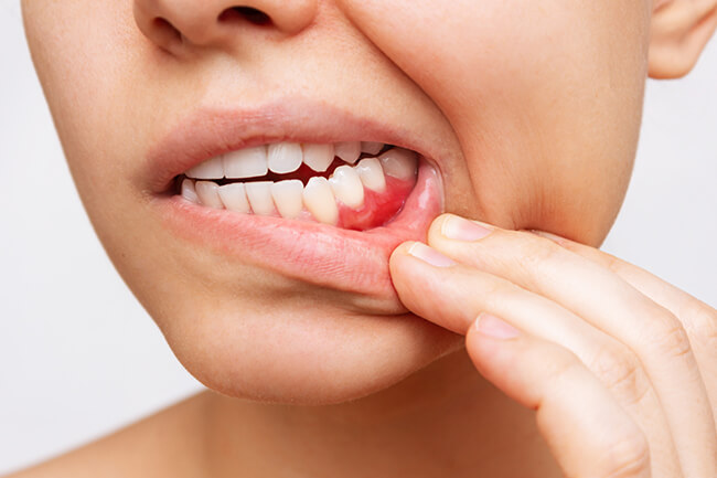 口腔内・口腔外のお悩み