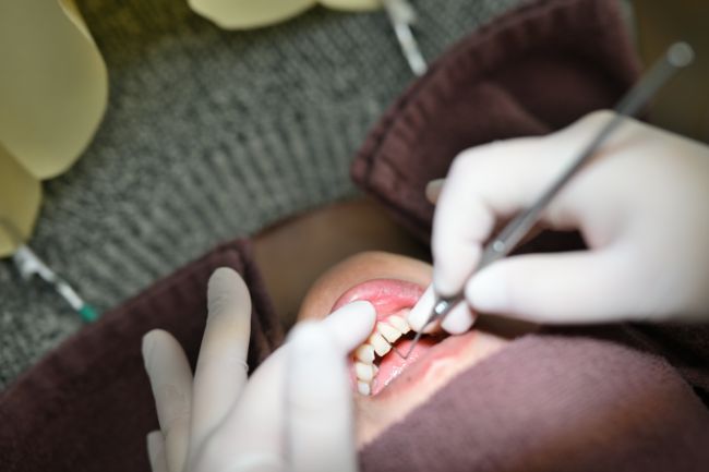 口腔内チェック